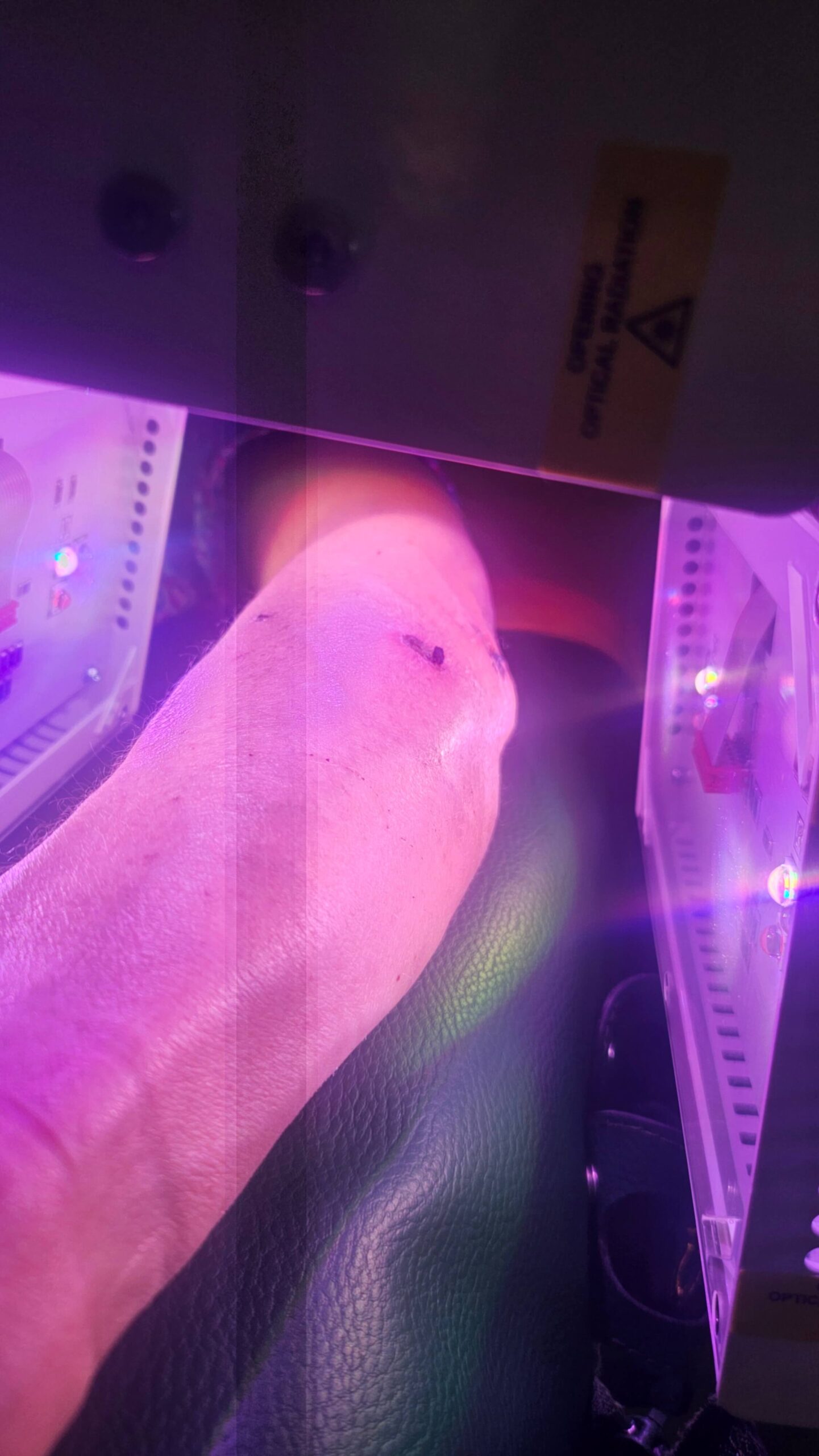Un patient de la demeure du mieux-être en pleine séance de photobiomodulation